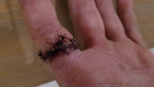 Were the stitches worth the mantel?